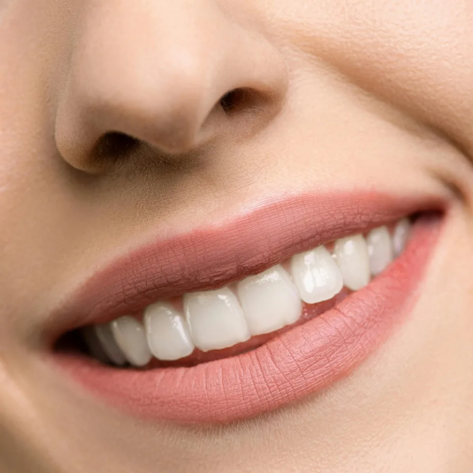 diseno-sonrisa diseno-sonrisa